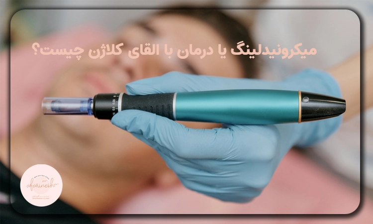 میکرونیدلینگ یا درمان با القای کلاژن
