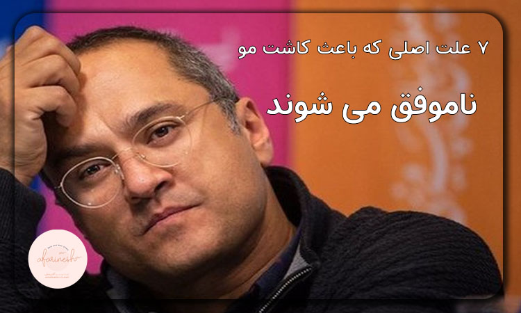 کاشت مو ناموفق