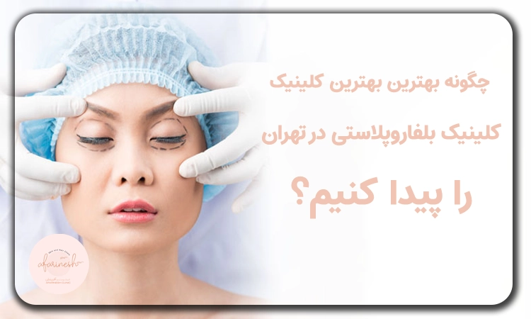 چگونه بهترین کلینیک بلفاروپلاستی تهران را پیدا کنیم؟