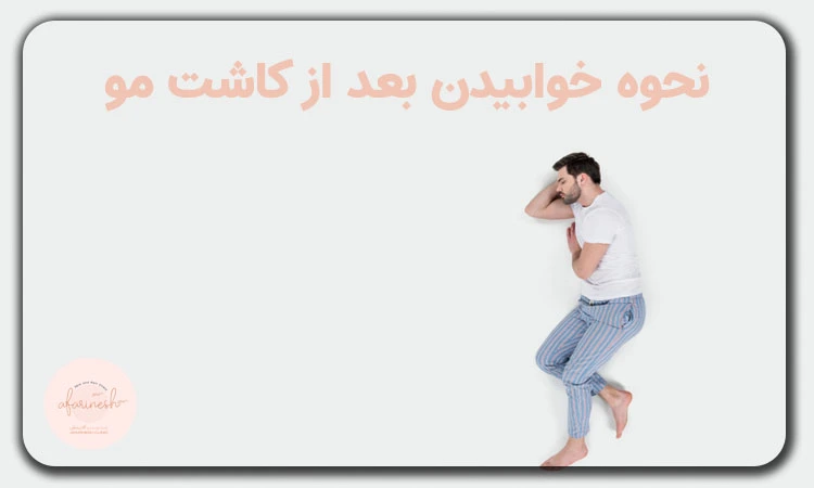 نحوه خوابیدن بعد از کاشت مو