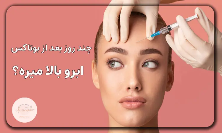 چند روز بعد از بوتاکس ابرو بالا میره؟