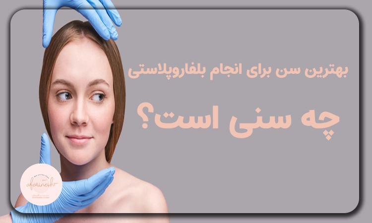 بهترین سن برای عمل بلفاروپلاستی