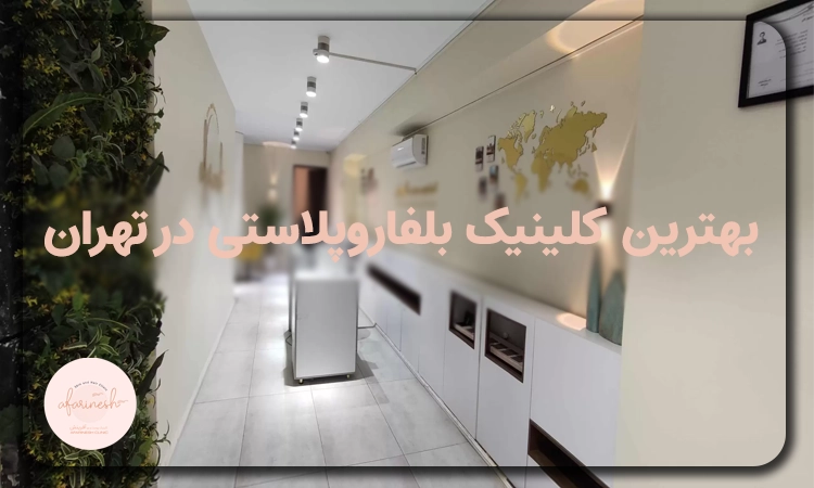 شناسایی بهترین کلینیک بلفاروپلاستی در تهران