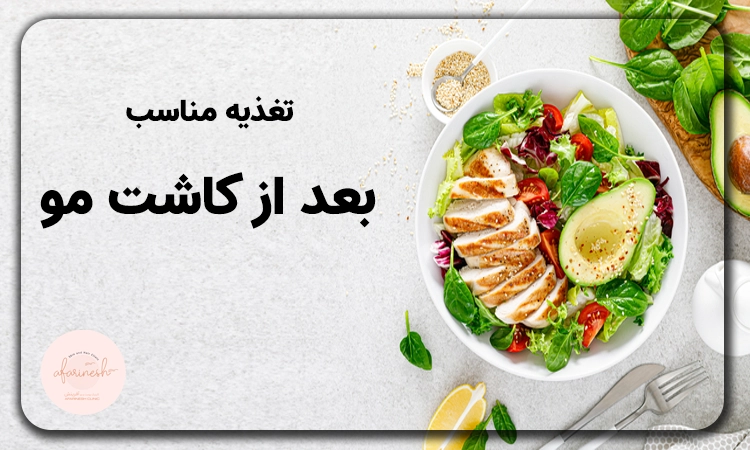 بعد از کاشت مو چی بخوریم