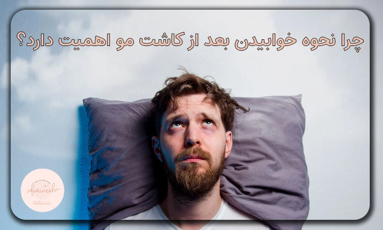 چرا نحوه خوابیدن بعد کاشت مو اهمیت دارد؟