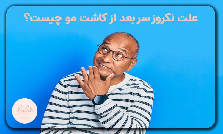 علت نکروز سر بعد از کاشت مو