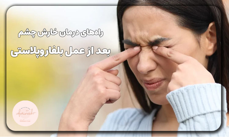 راه درمان خارش چشم بعد از عمل بلفاروپلاستی
