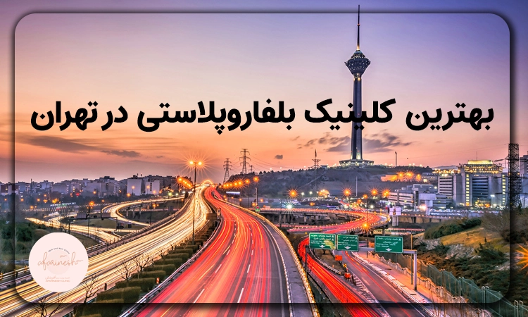 بهترین کلینیک بلفاروپلاستی در تهران