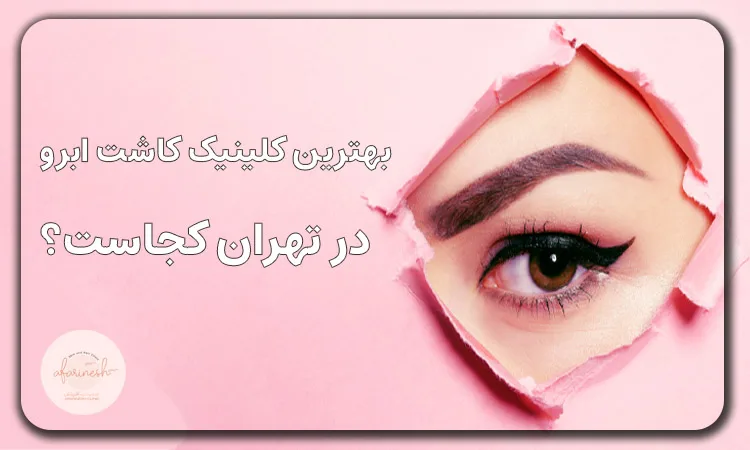 بهترین کلینیک کاشت ابرو در تهران