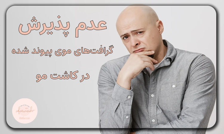 عدم پذیرش گرافت‌ های موی پیوند شده در کاشت مو