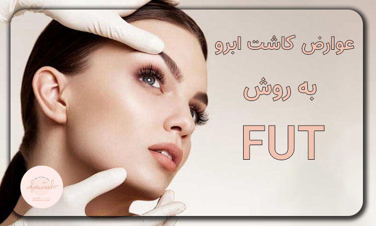 عوارض کاشت ابرو به روش fut و fue