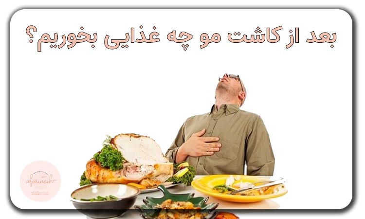 بعد از کاشت مو چی بخوریم