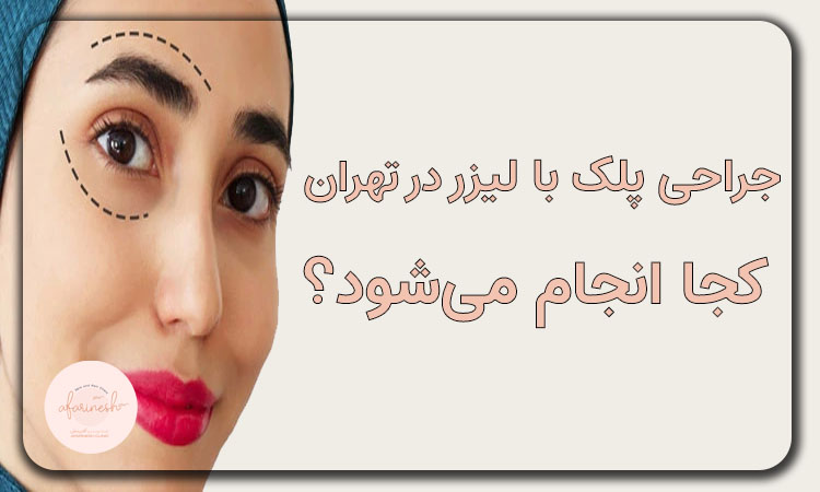 جراحی پلک با لیزر در تهران