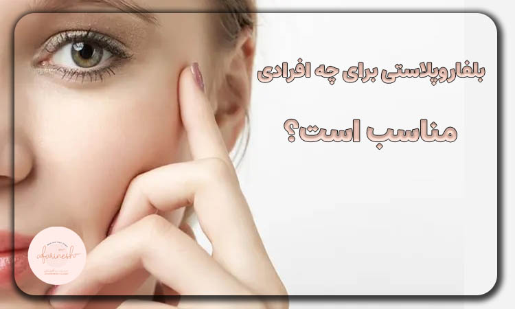 کاندیدای بلفاروپلاستی