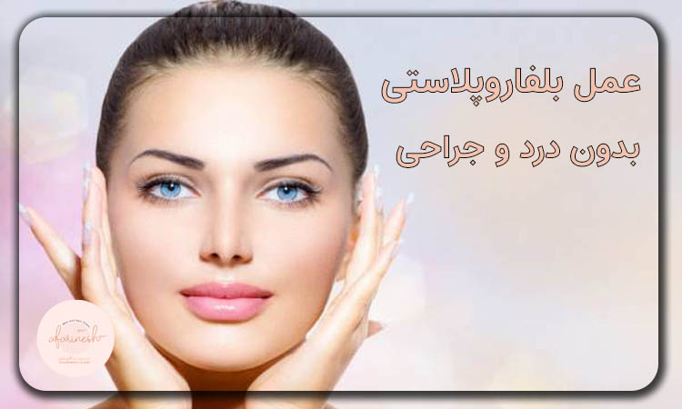 عمل بلفاروپلاستی بدون درد و جراحی