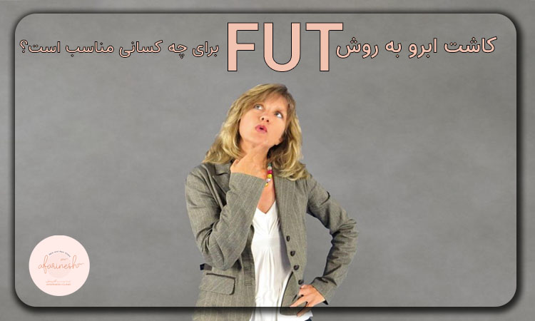 کاندیدای کاشت ابرو به روش fut