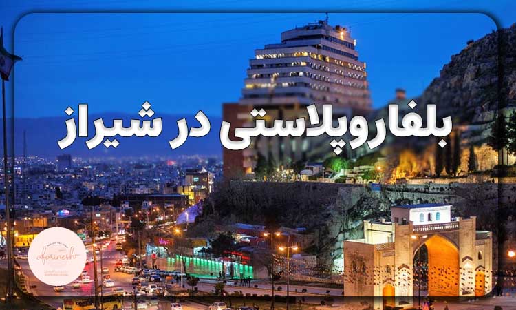بلفاروپلاستی در شیراز
