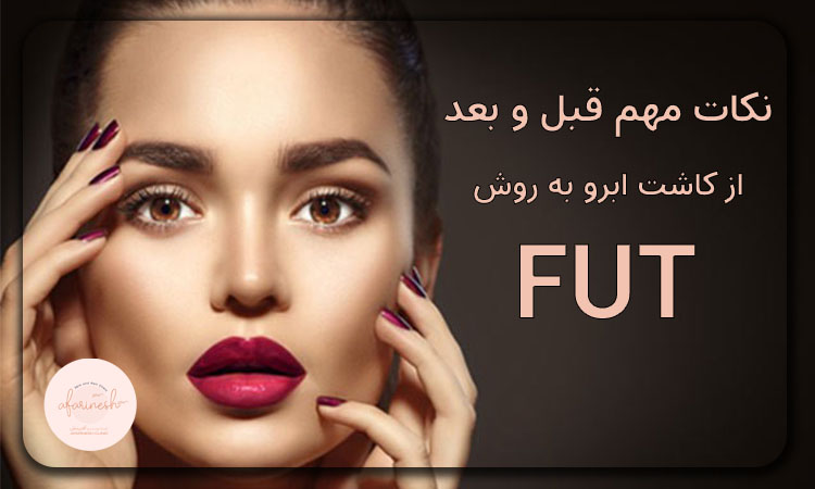نکات مهم قبل و بعد کاشت ابرو به روش FUT