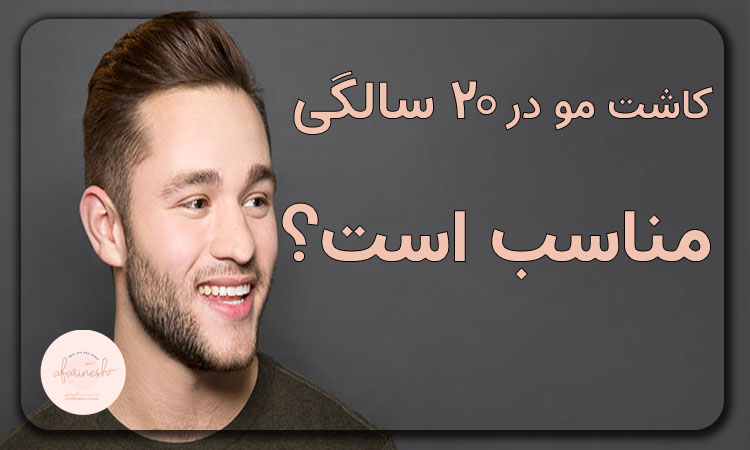 کاشت مو در ۲۰ سالگی مناسب است؟