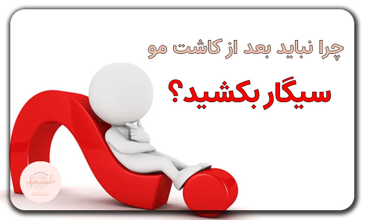 چرا نباید بعد از کاشت مو سیگار کشید؟