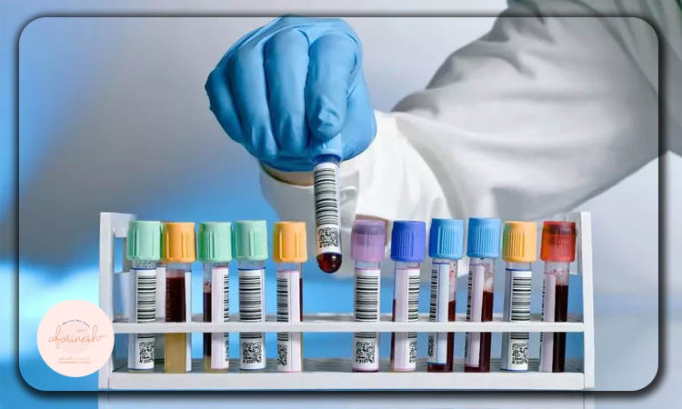 آزمایشات قبل از کاشت ابرو