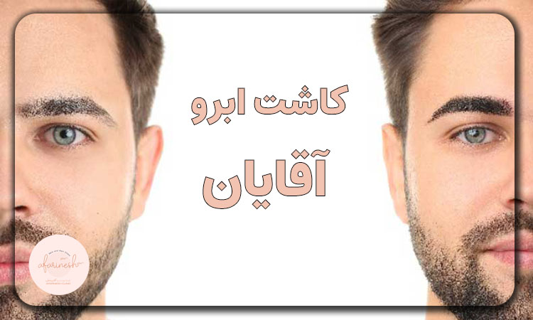 کاشت ابرو مردانه