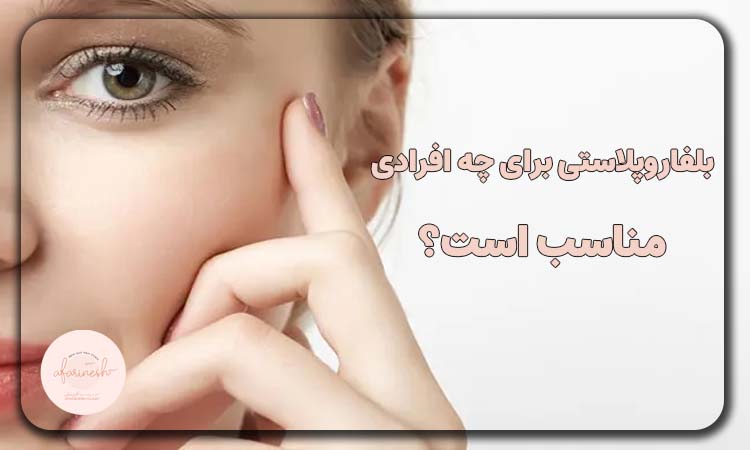 بلفاروپلاستی برای چه افرادی مناسب است؟