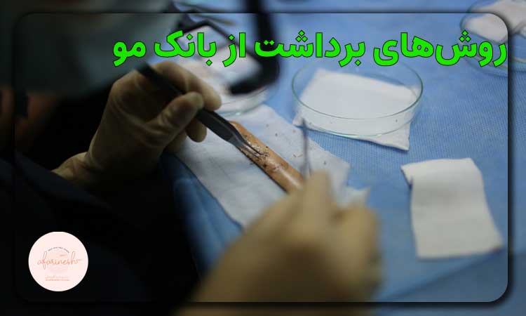 روشهای برداشت از بانک مو