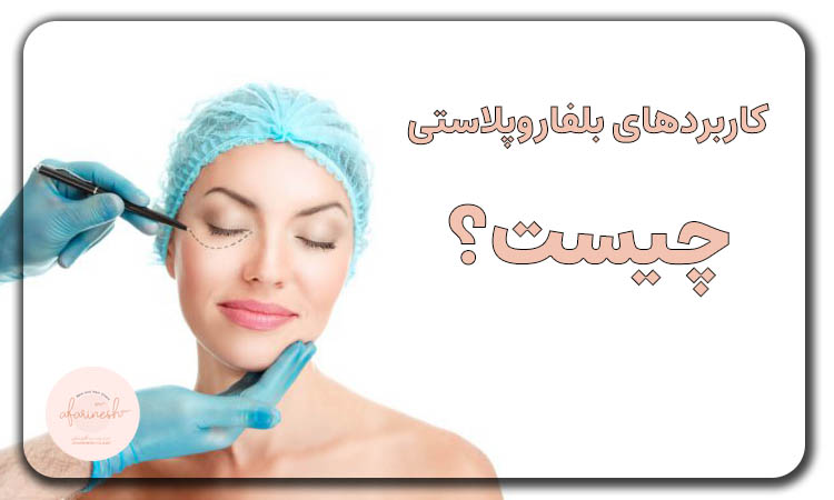 کاربردهای بلفاروپلاستی