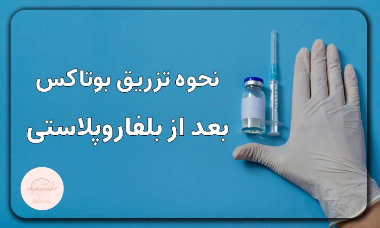 نحوه تزریق بوتاکس بعد بلفاروپلاستی