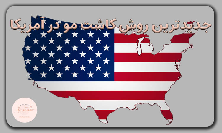 جدیدترین روش کاشت مو در امریکا