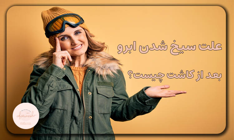 علت سیخ شدن ابرو بعد از کاشت