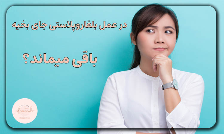 جای بخیه عمل بلفاروپلاستی
