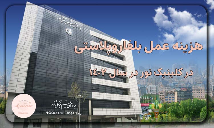 هزینه عمل بلفاروپلاستی در کلینیک نور