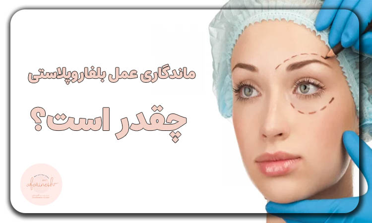 ماندگاری عمل بلفاروپلاستی