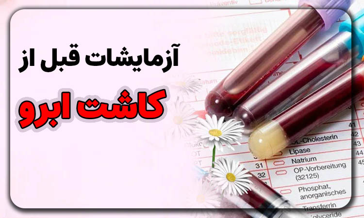برای آزمایش کاشت ابرو باید ناشتا بود؟