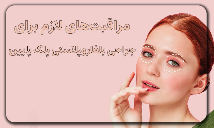 مراقبتهای لازم جراحی بلفاروپلاستی پلک پایین