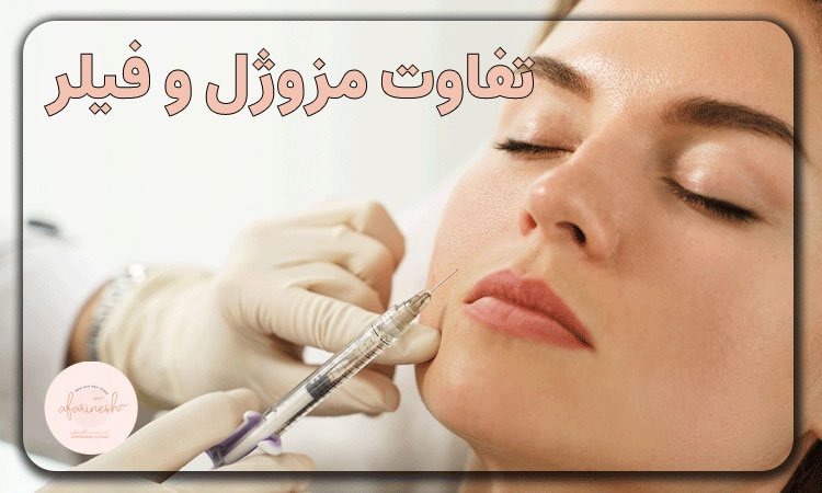 تفاوت مزوژل و فیلر