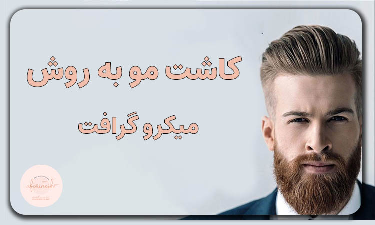 کاشت مو میکرو گرافت