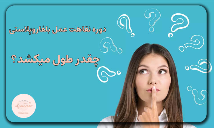 دوره نقاهت عمل بلفاروپلاستی