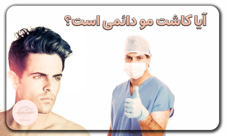 ایا کاشت مو دائمی است