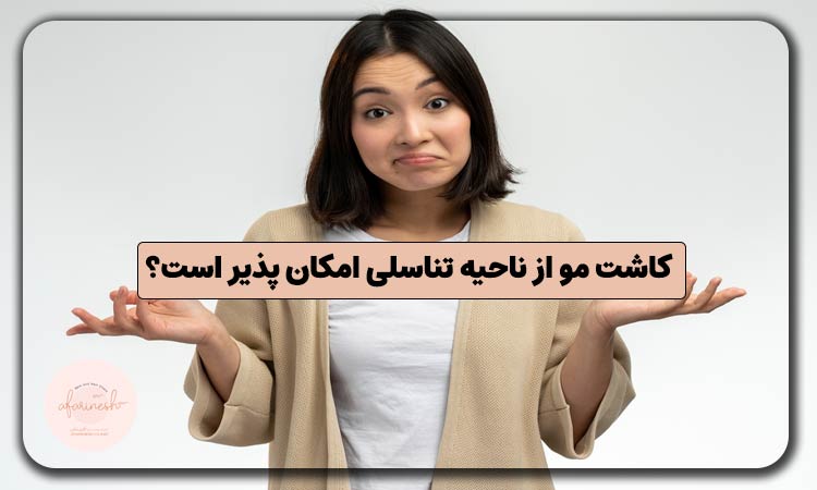 کاشت مو از ناحیه تناسلی