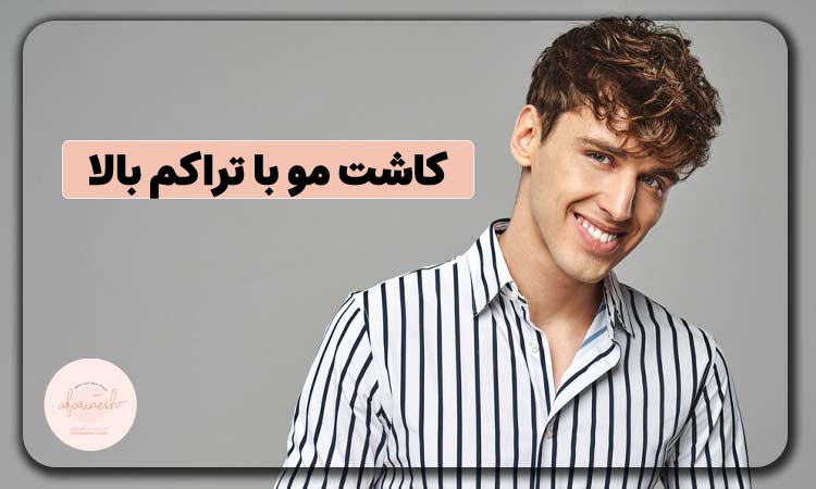کاشت مو با تراکم بالا