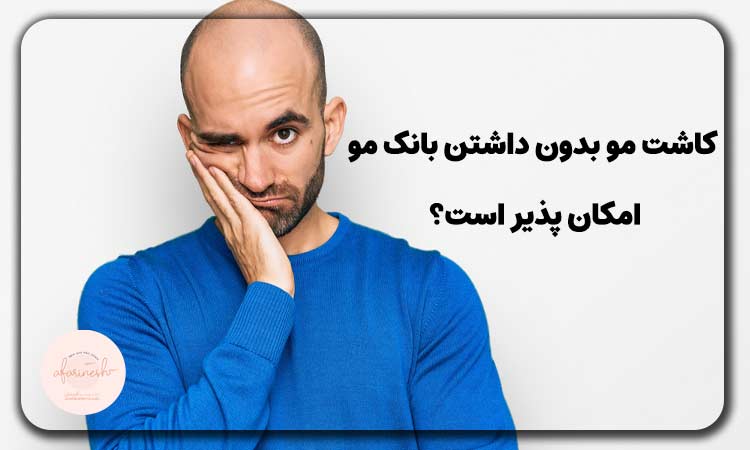 کاشت مو بدون داشتن بانک مو امکان پذیر است؟