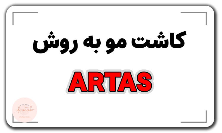 کاشت مو به روش artas