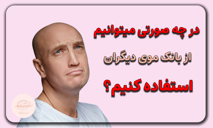 در چه صورتی میتوان از بانک موی دیگران استفاده کنیم؟