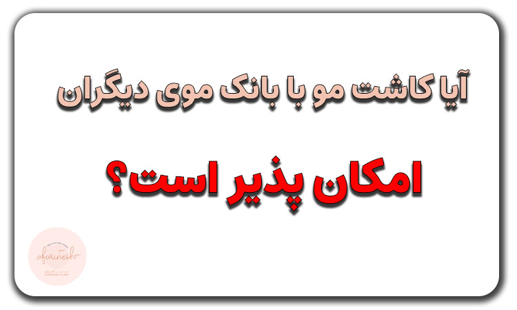 کاشت مو با بانک موی دیگران
