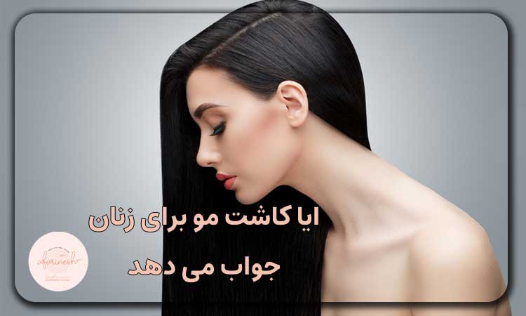 ایا کاشت مو برای زنان جواب می دهد