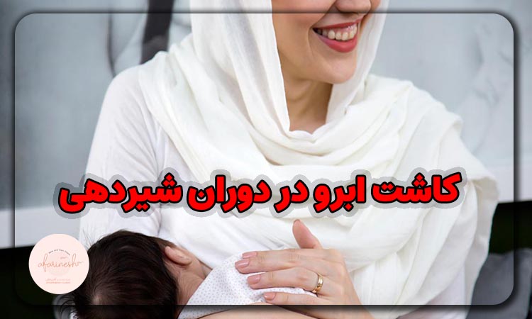 کاشت ابرو در شیردهی
