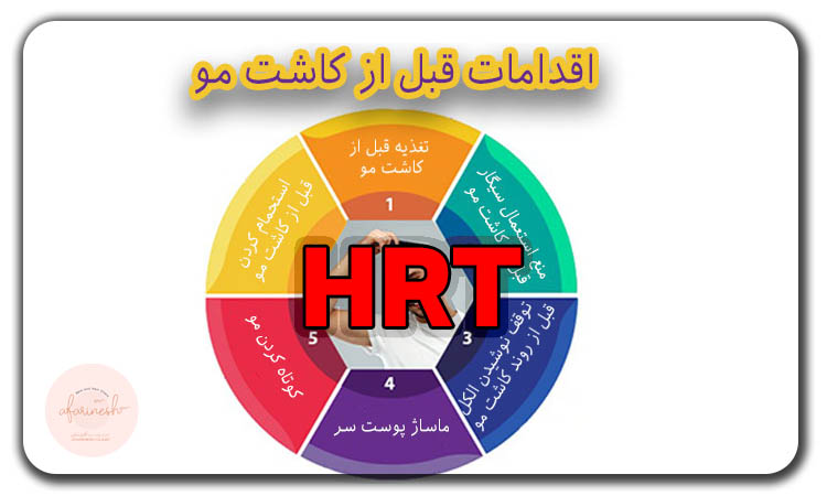 اقدامات قبل از کاشت مو